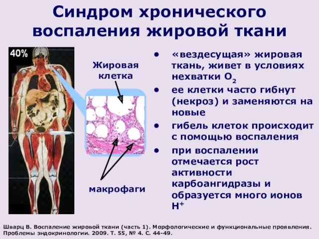 Синдром хронического воспаления жировой ткани Жировая клетка макрофаги Шварц В.