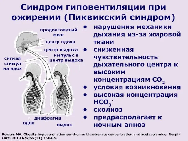 Синдром гиповентиляции при ожирении (Пиквикский синдром) нарушения механики дыхания из-за