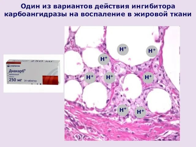 Один из вариантов действия ингибитора карбоангидразы на воспаление в жировой ткани