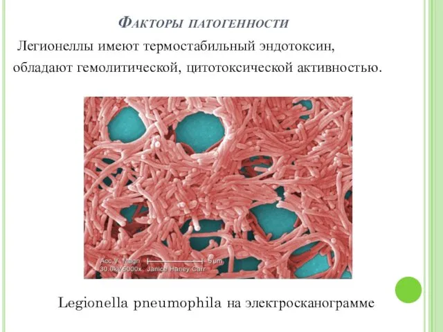 Факторы патогенности Легионеллы имеют термостабильный эндотоксин, обладают гемолитической, цитотоксической активностью. Legionella pneumophila на электросканограмме