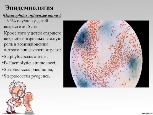 Эпидемиология Haemophilus influenzae типа b – 95% случаев у детей в возрасте до