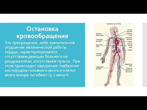 Остановка кровообращения Это прекращение, либо значительное ухудшение механической работы сердца,