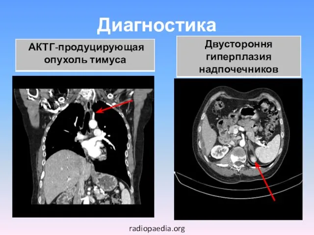 Диагностика radiopaedia.org