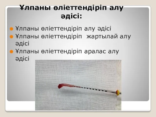 Ұлпаны өліеттендіріп алу әдісі: Ұлпаны өліеттендіріп алу әдісі Ұлпаны өліеттендіріп