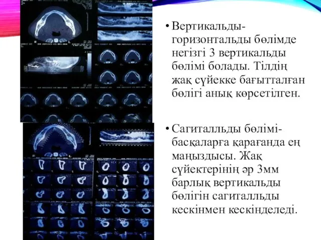 Вертикальды-горизонтальды бөлімде негізгі 3 вертикальды бөлімі болады. Тілдің жақ сүйекке