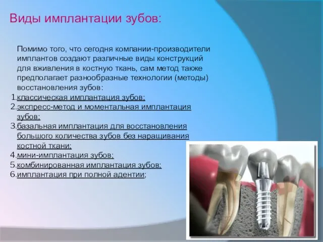 Помимо того, что сегодня компании-производители имплантов создают различные виды конструкций