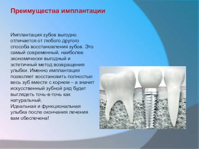 Преимущества имплантации Имплантация зубов выгодно отличается от любого другого способа