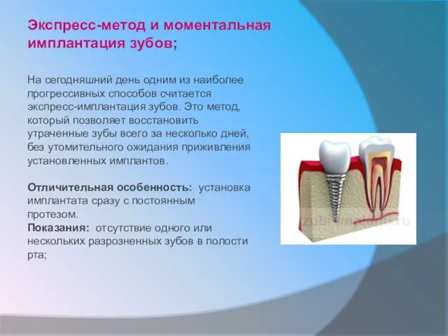 Экспресс-метод и моментальная имплантация зубов; На сегодняшний день одним из