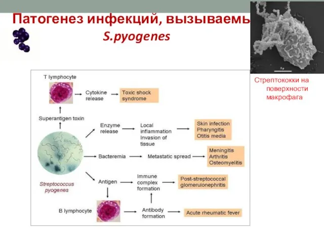 Патогенез инфекций, вызываемых S.pyogenes Стрептококки на поверхности макрофага