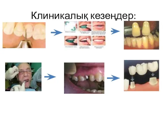 Клиникалық кезеңдер: