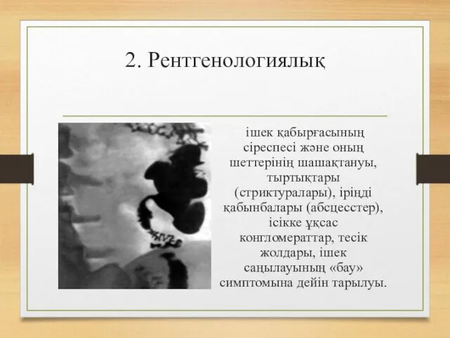 2. Рентгенологиялық ішек қабырғасының сіреспесі жəне оның шеттерінің шашақтануы, тыртықтары