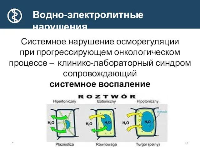 Системное нарушение осморегуляции при прогрессирующем онкологическом процессе – клинико-лабораторный синдром сопровождающий системное воспаление Водно-электролитные нарушения *