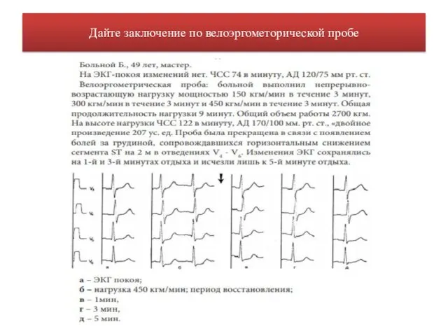 Дайте заключение по велоэргометорической пробе