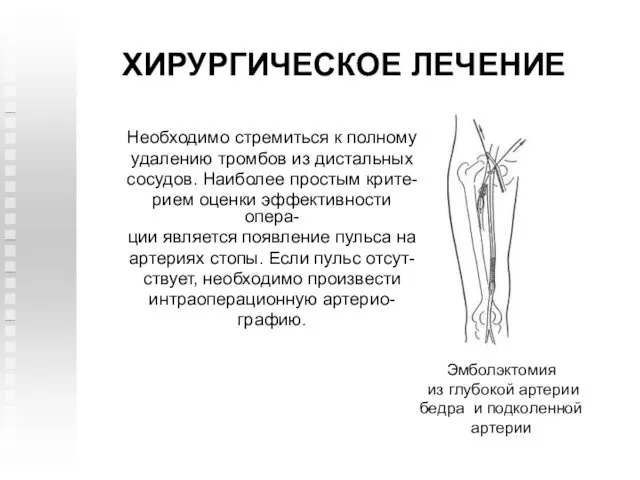 ХИРУРГИЧЕСКОЕ ЛЕЧЕНИЕ Необходимо стремиться к полному удалению тромбов из дистальных