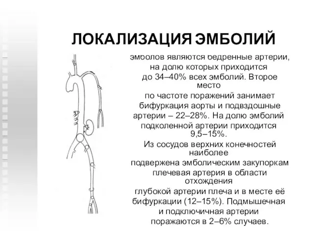 Излюбленным местом локализации эмболов являются бедренные артерии, на долю которых