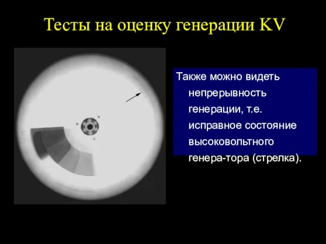 Тесты на оценку генерации KV Также можно видеть непрерывность генерации, т.е. исправное состояние высоковольтного генера-тора (стрелка).