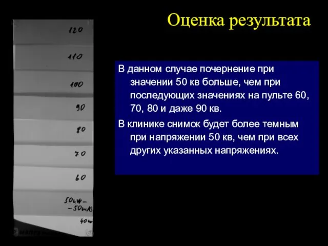 Оценка результата В данном случае почернение при значении 50 кв больше, чем при