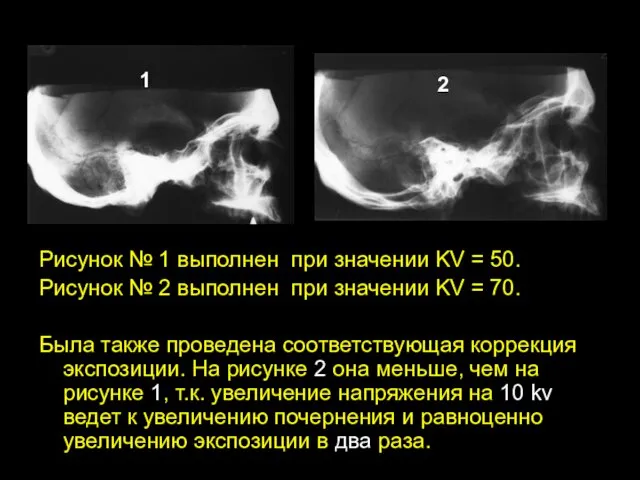 Рисунок № 1 выполнен при значении KV = 50. Рисунок