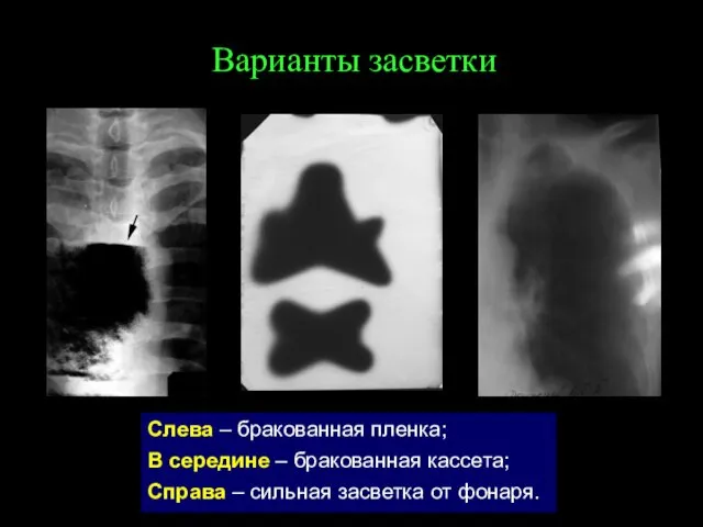 Варианты засветки Слева – бракованная пленка; В середине – бракованная кассета; Справа –