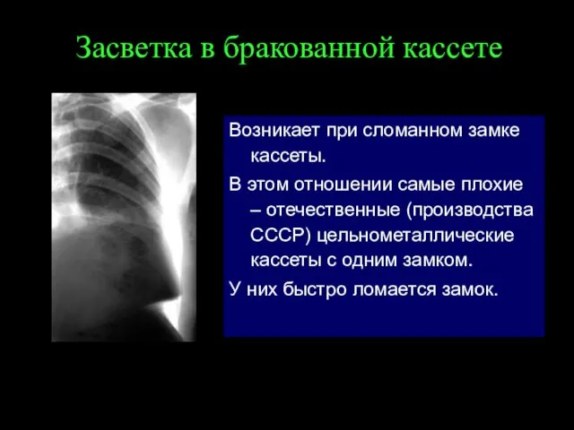 Засветка в бракованной кассете Возникает при сломанном замке кассеты. В