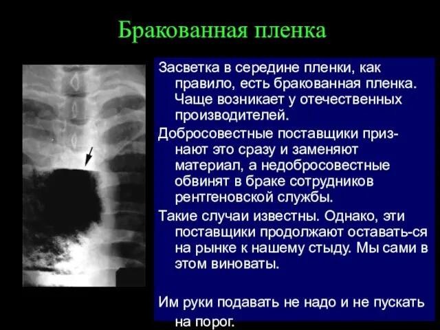 Бракованная пленка Засветка в середине пленки, как правило, есть бракованная пленка. Чаще возникает