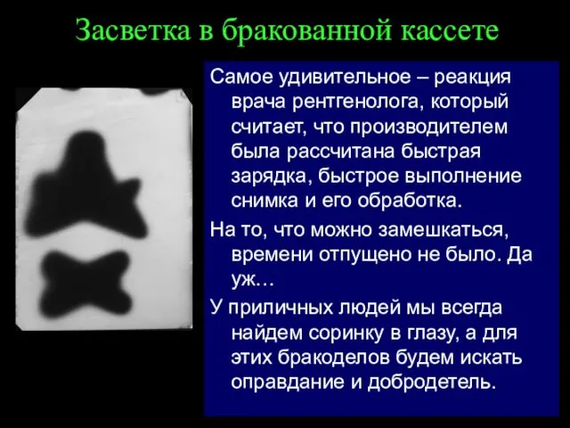 Засветка в бракованной кассете Самое удивительное – реакция врача рентгенолога, который считает, что