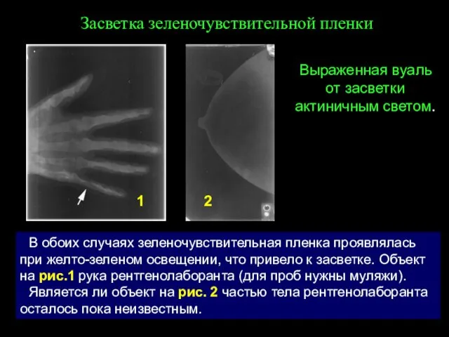 Засветка зеленочувствительной пленки 1 2 В обоих случаях зеленочувствительная пленка