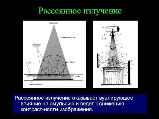 Рассеянное излучение Рассеянное излучение оказывает вуалирующее влияние на эмульсию и ведет к снижению контраст-ности изображения.