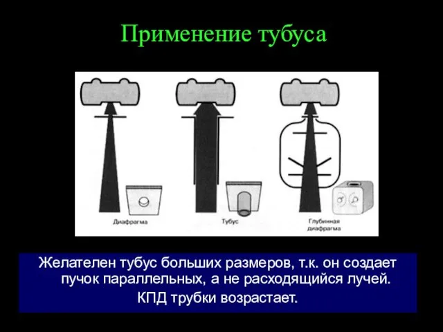 Применение тубуса Желателен тубус больших размеров, т.к. он создает пучок