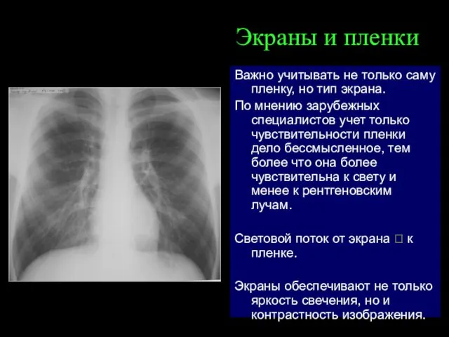 Экраны и пленки Важно учитывать не только саму пленку, но тип экрана. По