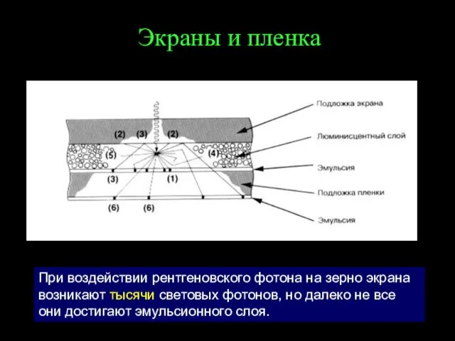 Экраны и пленка При воздействии рентгеновского фотона на зерно экрана возникают тысячи световых