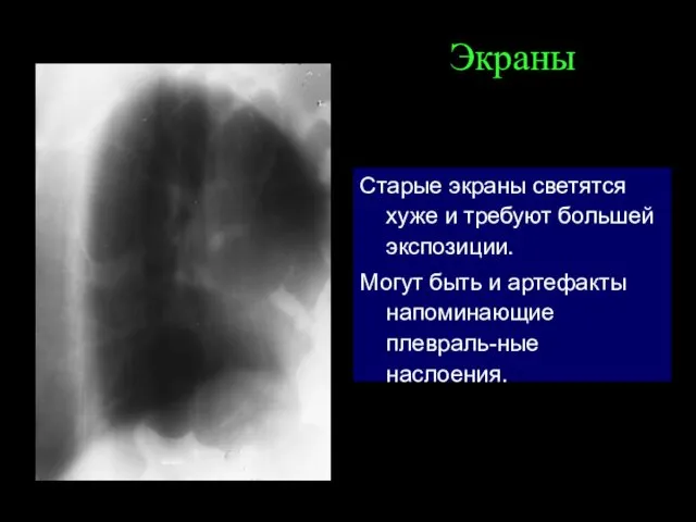 Экраны Старые экраны светятся хуже и требуют большей экспозиции. Могут быть и артефакты напоминающие плевраль-ные наслоения.