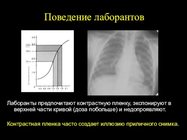 Поведение лаборантов Лаборанты предпочитают контрастную пленку, экспонируют в верхней части