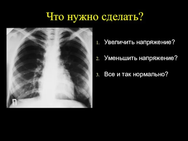 Что нужно сделать? Увеличить напряжение? Уменьшить напряжение? Все и так нормально?