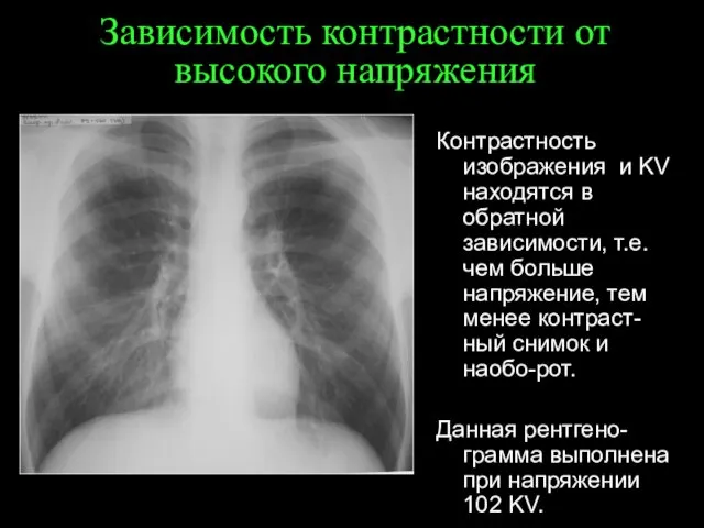 Зависимость контрастности от высокого напряжения Контрастность изображения и KV находятся