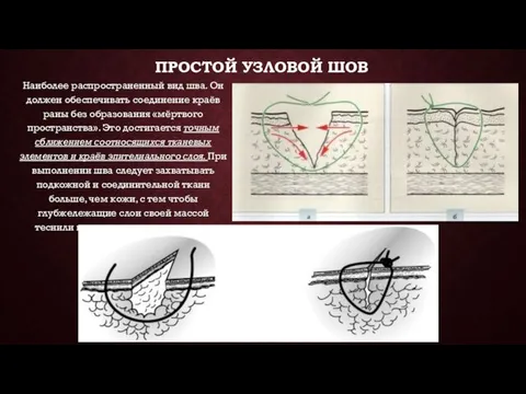 ПРОСТОЙ УЗЛОВОЙ ШОВ Наиболее распространенный вид шва. Он должен обеспечивать