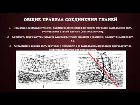 ОБЩИЕ ПРАВИЛА СОЕДИНЕНИЯ ТКАНЕЙ Послойное соединение тканей. Каждый рассеченный в