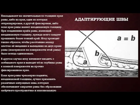 АДАПТИРУЮЩИЕ ШВЫ Накладывают на значительные по толщине края раны, либо