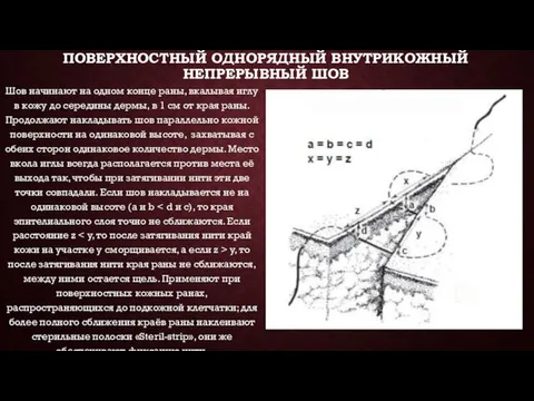 ПОВЕРХНОСТНЫЙ ОДНОРЯДНЫЙ ВНУТРИКОЖНЫЙ НЕПРЕРЫВНЫЙ ШОВ Шов начинают на одном конце