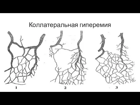 Коллатеральная гиперемия