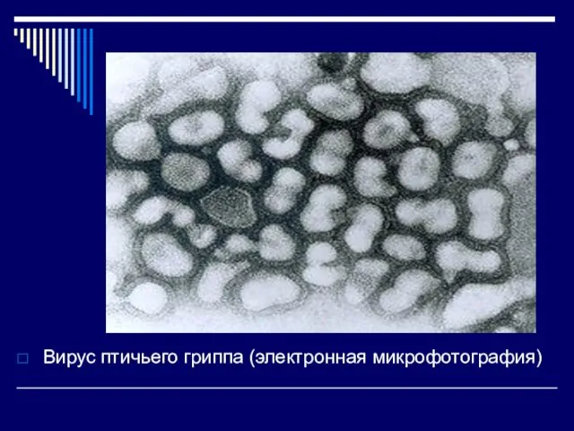 Вирус птичьего гриппа (электронная микрофотография)