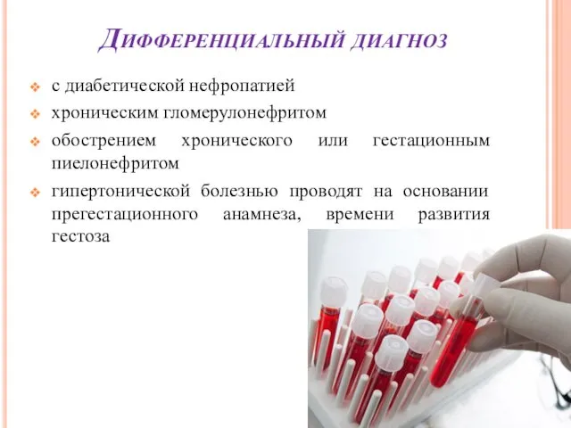 Дифференциальный диагноз с диабетической нефропатией хроническим гломерулонефритом обострением хронического или