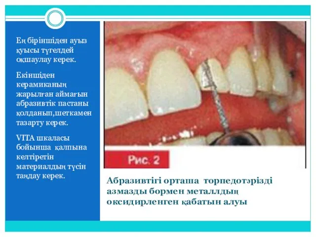 Абразивтігі орташа торпедотәрізді азмазды бормен металлдың оксидирленген қабатын алуы Ең