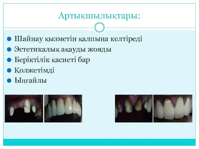 Артықшылықтары: Шайнау қызметін қалпына келтіреді Эстетикалық ақауды жояды Беріктілік қасиеті бар Қолжетімді Ыңғайлы