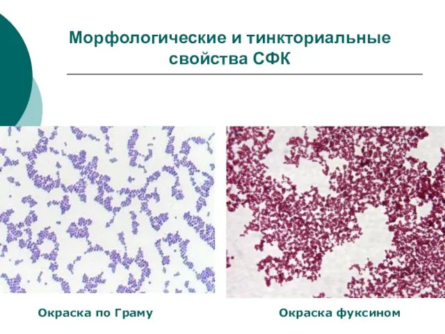 Морфологические и тинкториальные свойства СФК Окраска по Граму Окраска фуксином