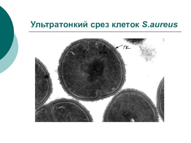 Ультратонкий срез клеток S.aureus
