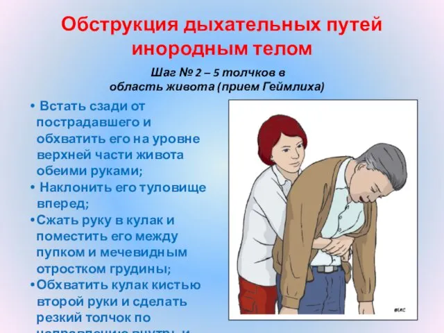 Обструкция дыхательных путей инородным телом Шаг № 2 – 5 толчков в область