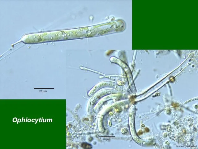 Ophiocytium