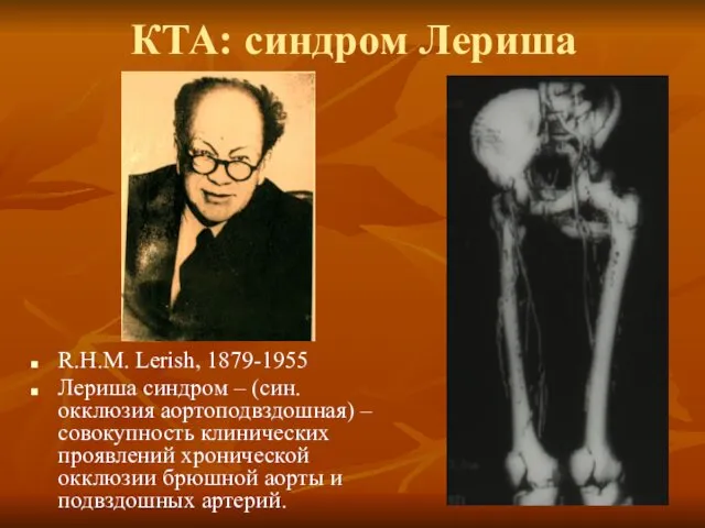 КТА: синдром Лериша R.H.M. Lerish, 1879-1955 Лериша синдром – (син.