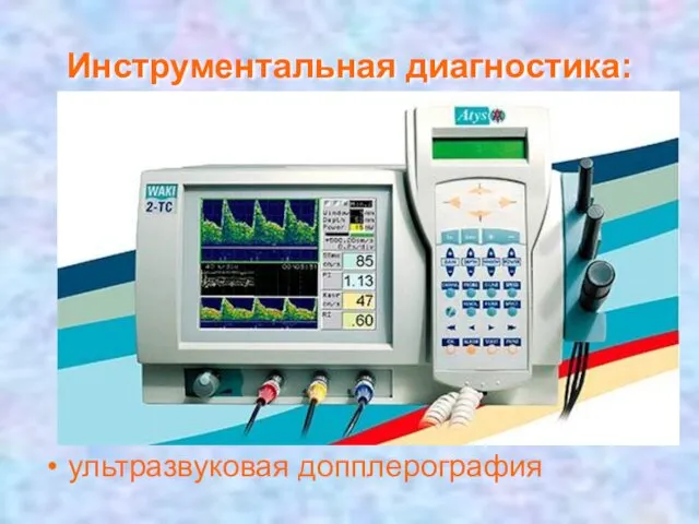 Инструментальная диагностика: ультразвуковая допплерография